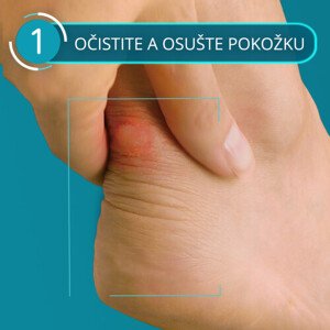 COMPEED náplasť na pľuzgiere stredná gélová 10 ks